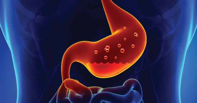 sintomas da gastrite